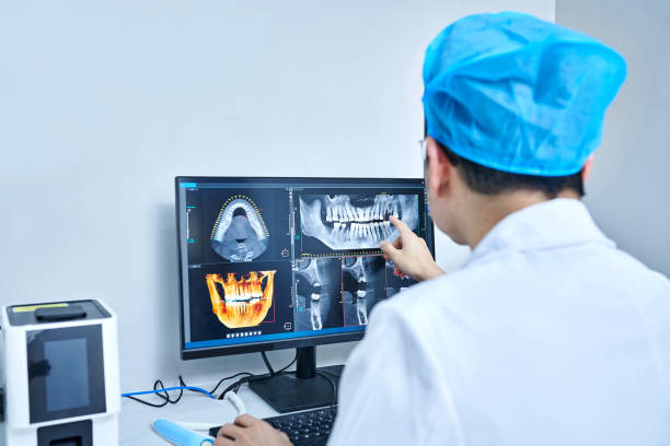 Best Emergency Treatment for Dental Infections or Abscesses in Springmont, PA